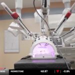 Attachment for New robotic kidney surgery could increase donor eligibility in Iowa